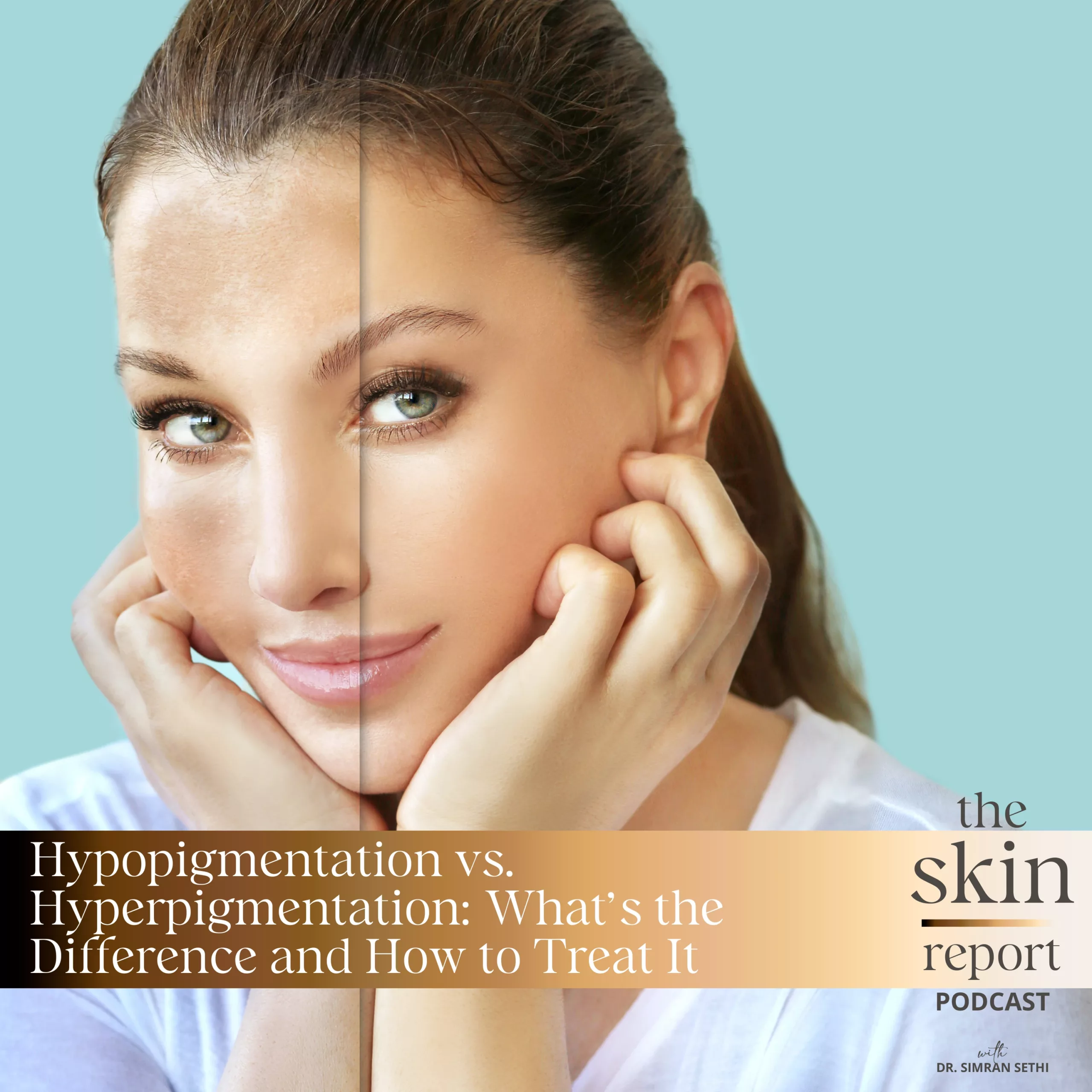 Hypopigmentation vs. Hyperpigmentation: What’s the Difference and How to Treat It | The SKIN Report Podcast with Dr. Simran Sethi