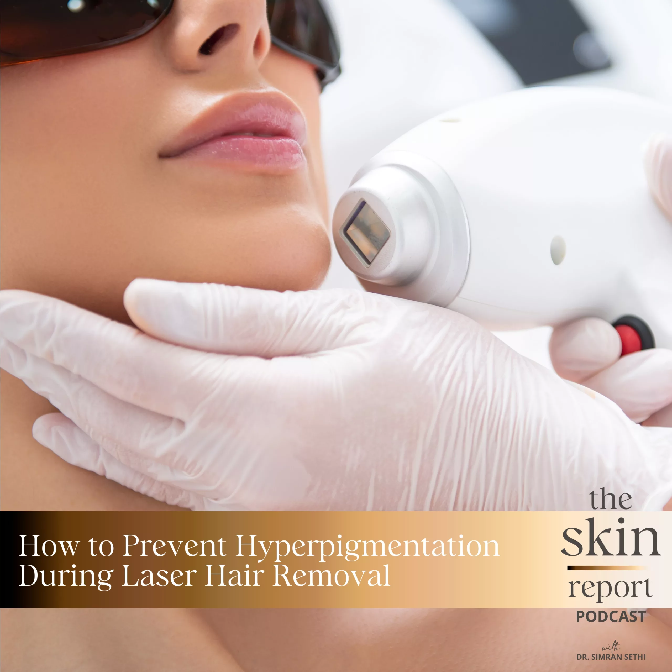 How to Prevent Hyperpigmentation During Laser Hair Removal | The SKIN Report Podcast with Dr. Simran Sethi