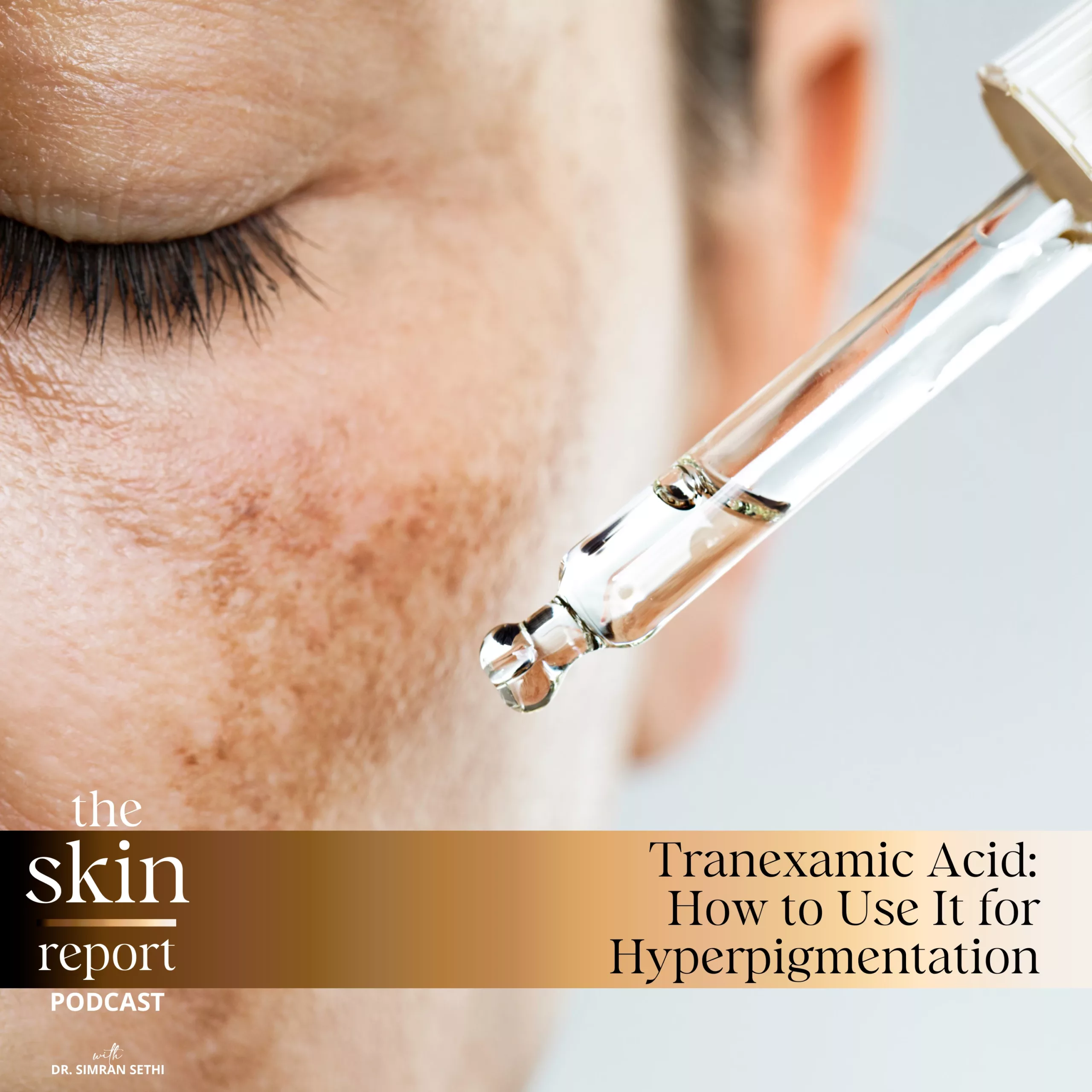 Tranexamic Acid: How to Use it for Hyperpigmentation | The SKIN Report Podcast with Dr. Simran Sethi