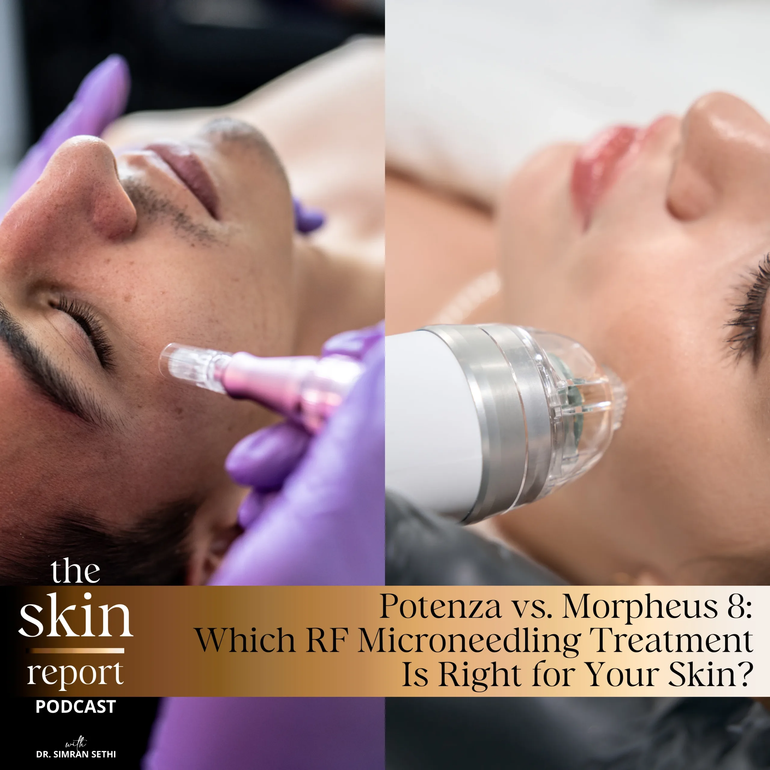 Potenza vs. Morpheus 8: Which RF Microneedling Treatment Is Right for Your Skin? | The SKIN Report Podcast with Dr. Simran Sethi