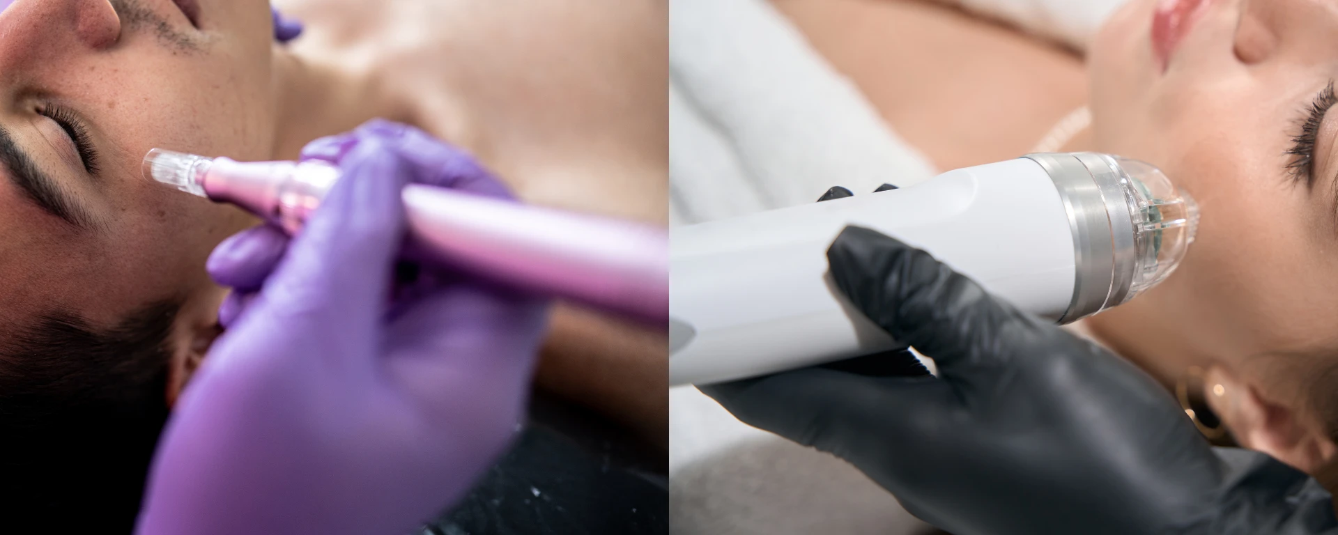 Potenza vs. Morpheus 8: Which RF Microneedling Treatment Is Right for Your Skin? | The SKIN Report Podcast with Dr. Simran Sethi
